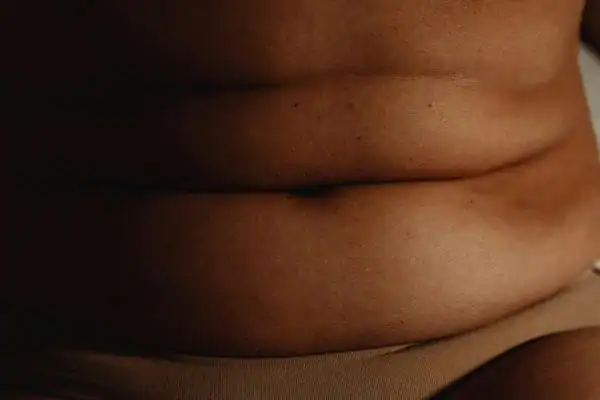 The Hidden Connection: How Stress Shapes Your Fitness and Body Composition 3 image of what stress can do on the stomach area and how Lipo 360 Herne can help to change your body shape.