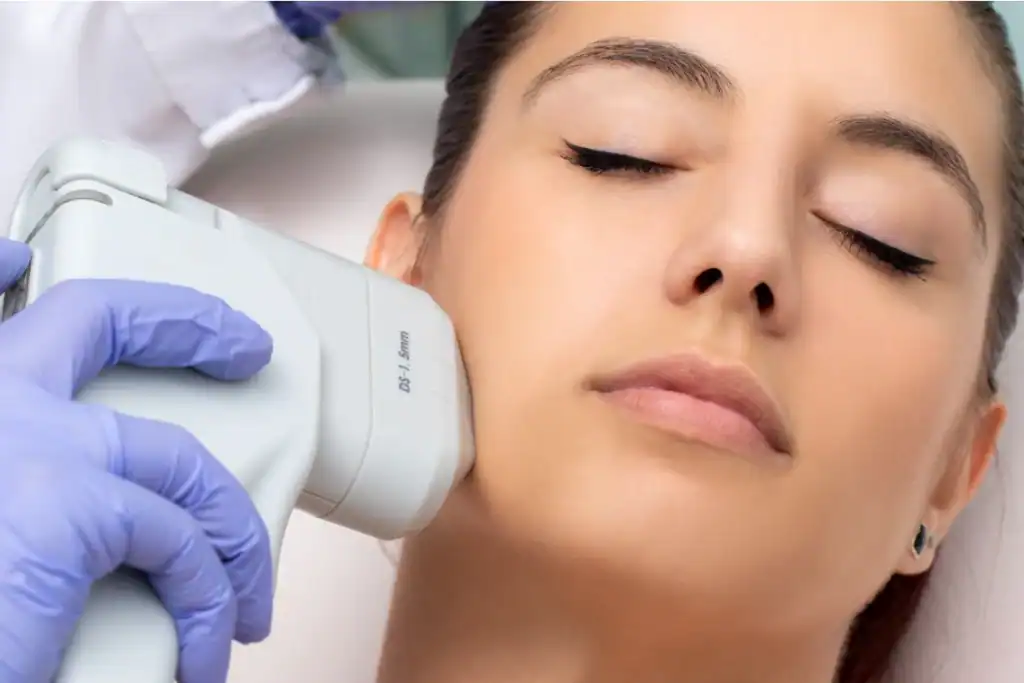 Discover the Perfect Duo: RF Microneedling and HIFU 2 Image of Morpheus8 And HIFU Combined with Lipo 360 Herne